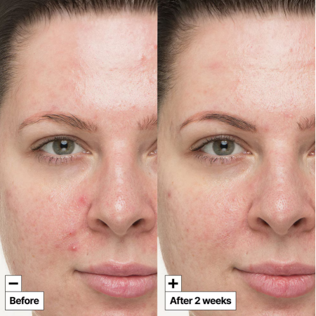 Comar Profumerie | Dr.Jart+ | Cicapair | So Soothing Treatment