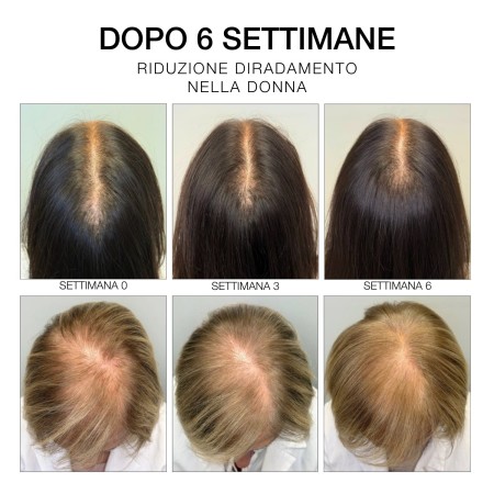 Diego dalla Palma | Hair | Estremi Rimedi | Siero 6