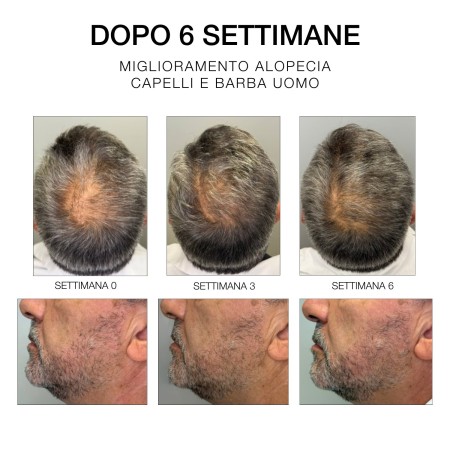 Diego dalla Palma | Hair | Estremi Rimedi | Siero 6