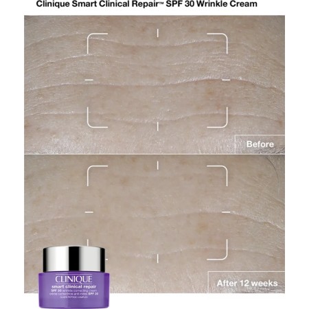 Comar Profumerie| Clinique | Smart Clinical Repair | Wrinkle Correcting Cream